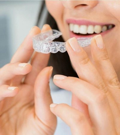 Close-up of a woman holding a clear dental aligner, showcasing dental health and a bright smile.